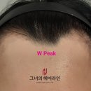 그녀의헤어라인의원 이미지