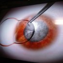 서울성모안과병원 이미지