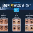 세미성형외과의원 네이버블로그