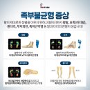 레푸스 이미지