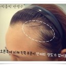 렉스헤어라인