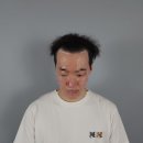 남원장 | 남자헤어라인 M자탈모커버 생생후기 전달드릴께요.