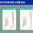 오래 앉아있으면 생기는 문제 앉아있을때 허리통증 이미지