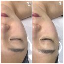 대주피오레정문 | 기흥 공세동 리프팅 잘하는 피부관리샵! 올가드림뷰티탑실마을점 다녀온 내돈내산 리얼 후기