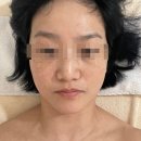 둔산중로 | 둔산동피부관리-오와스킨 플라샤워 후기 (대전피부관리,대전문제성피부)