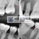 서울조아치과 이미지