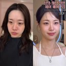 유림-7 | 청담 웨딩 촬영 메이크업 헤어 유림 피부커버 후기