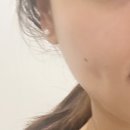 광주 유동 피부관리 이플에스테틱, 물방울 리프팅 후기