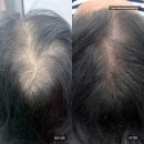 능포동 옥수시장 앞 | 정수리 문신추천 이수역두피 사당역두피 1회차 솔직후기 대만족ㅣ시장눈썹 본점