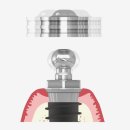 이노바이오써지 이미지