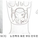 [김선애CST-Brain연구소] 연하장애(Dysphagia) 이미지