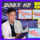 방아쇠수지증후군 수술없이 치료하는 운동법 이미지