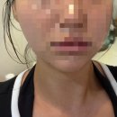 미인본가 - 파주시 | [서울/신도림] 구로 피부관리 추천! 신도림 에스테틱 미인본가온 얼굴윤곽관리 후기