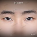 케이스성형외과의원 네이버블로그