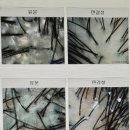 지에스25우송대스타점 | 안양 두피관리 웰킨두피탈모센터 두피스켈링 탈모관리 후기