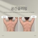 문창중학교 | [공간슬리밍] 보라매역바디관리 진짜 잘 하는 곳! 승모근 등관리 후기