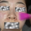 미가 | 부천피부관리 신부관리 전문샵 가인미가 후기