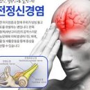 전정신경염 증상 및 어지러움 예방 이미지