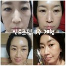 엔케이더블유