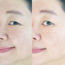 바이오벨리2로L | 주름개선 크림 바이오힐 보 프로바이오덤 3D 리프팅 L-PDRN 크림 40대 주름개선화장품 추천