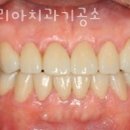 ONE치과기공소 이미지