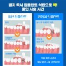 제아치과의원 네이버블로그