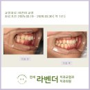 여의도 연세라벤더 교정 "4월 어린이 성장기 교정" 후기