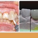 군산치과기공소 이미지