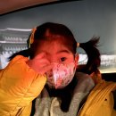 보계동물병원 | 서울대어린이병원에서 양성종양(유피낭종) 수술 후기2