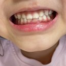 현재만치과의원 | 목동 교정치과 4곳 다녀오다