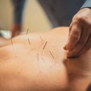 비노한의원 이미지