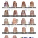 예손약국 | [사구체종양] 손톱밑통증, 예손병원 사구체종양 수술후기