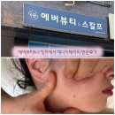 별내에너지 노동조합 | 에버뷰티&amp;스칼프 별내점 에너지테라피 부분관리 리얼 후기