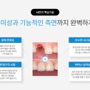 ID기공소 네이버블로그
