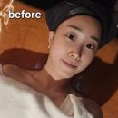 라스트뷰티 | [청담] 강남마사지 청담에스테틱 뷰티블르바드 윤곽관리 신부관리 리얼 후기