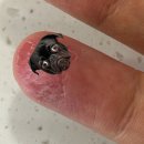 희약국 | 주부습진 연고 추천 초기증상 약국템 노바손크림 사용 후기!