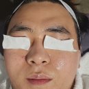 케어랜드메디칼 | 부천 피부관리 잘하는 곳 람스킨케어 물방울 리프팅 관리 받은 솔직후기