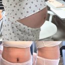 녹차 다이어트 출산후 체중관리 라인업 가인핏 후기