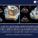 (주)고려메디칼 이미지