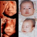 웃는얼굴 | 봄빛병원 27주 입체초음파 후기, 웃는 얼굴 포착 성공! :-)