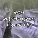 세상모든사랑니치과의원 | 세상모든사랑니치과 매복사랑니발치 금액후기 사랑니발치후기