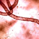 콜로라도에서 환자에게 최초의 에볼라 “백신” 주입 이미지