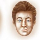[사이언스타임즈] 기형적 얼굴을 만드는 유전병은? 21세기는 신드롬 시대(27) 헌터 증후군 이미지
