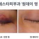 하루멍 이미지