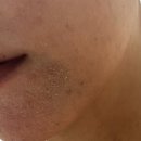 영보테크 | [강서 피부과] 극건성 피부 고민이라면? 뷰커스의원 올리디아 120 콜라겐 스킨부스터 웨딩관리 후기