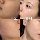 아나 피부샵