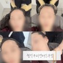 천안시 재활용센터 | 천안탈모관리 웰킨 두피탈모센터 천안신부점 방문후기