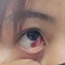 서울베스트안과의원 이미지