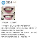 치아를 하얗게_루센트치과 치아미백 10점 만점에 10점 만점후기