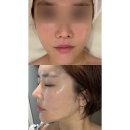 더봄웨딩앤드뷰티 | 앤드유뷰티스튜디오 | 평택 고덕 에스테틱 윤곽관리 탄력관리 후기